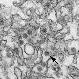 Micrografia eletrônica de células, núcleos e formas redondas.